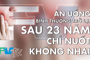 Phẫu thuật thành công cho người phụ nữ sau 23 năm bị cứng khít hàm