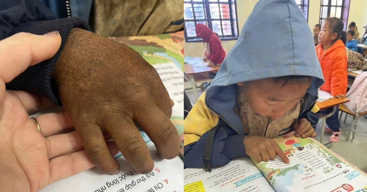 Phía sau bức ảnh bàn tay cậu bé 8 tuổi ở vùng cao khiến triệu người lay động