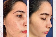 Bí mật của người có làn da đẹp tại Lam Beauty Clinic