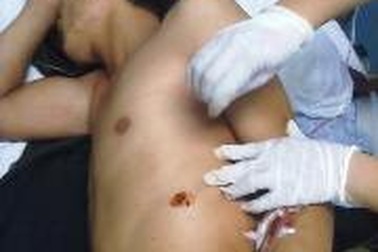 Triệu tập nhóm côn đồ hành hung 2 cảnh sát cơ động