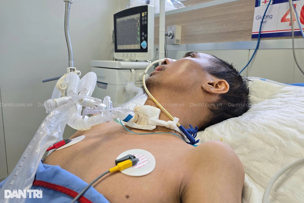 Vợ nghèo kiệt quệ khẩn cầu bạn đọc cứu chồng nguy kịch vì viêm não tự miễn - 5 Vợ nghèo kiệt quệ khẩn cầu bạn đọc cứu chồng nguy kịch vì viêm não tự miễn - 5