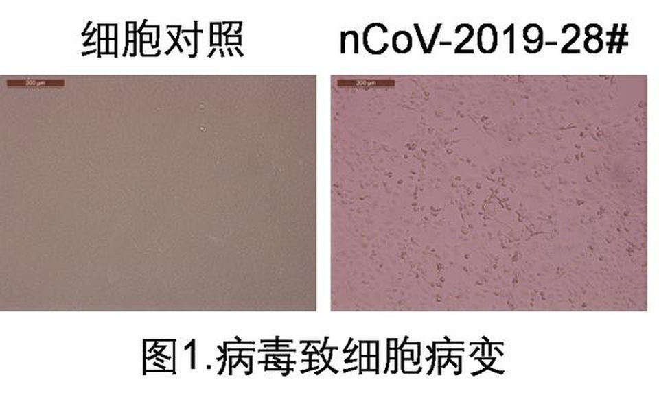 Trung Quốc phân lập được Covid-19 trong nước tiểu người bệnh - 1 Trung Quốc phân lập được Covid-19 trong nước tiểu người bệnh - 1
