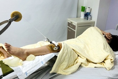 Truy tìm lái xe Range Rover vượt đèn đỏ, đâm nữ sinh dập não, gãy chân