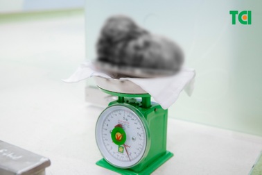 Đau quặn bụng, cô gái trẻ đi khám phát hiện khối u tới 2,1kg