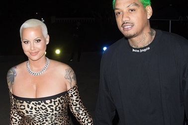 Vũ nữ thoát y thẩm mỹ toàn thân sau khi sinh nở