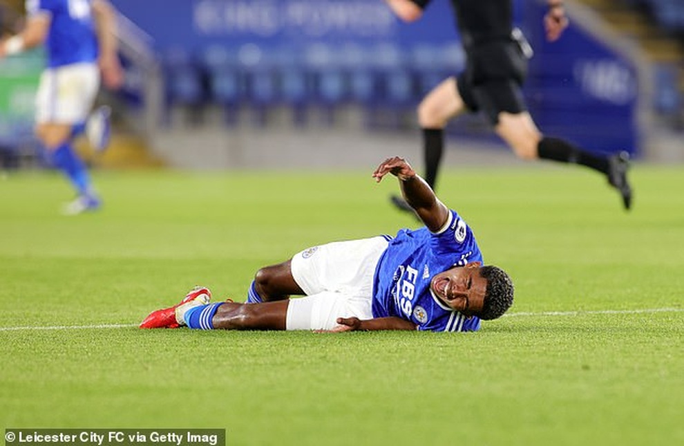 Ngôi sao trẻ Leicester gãy chân kinh hoàng khi đối thủ vào bóng thô bạo - 2 Ngôi sao trẻ Leicester gãy chân kinh hoàng khi đối thủ vào bóng thô bạo - 2