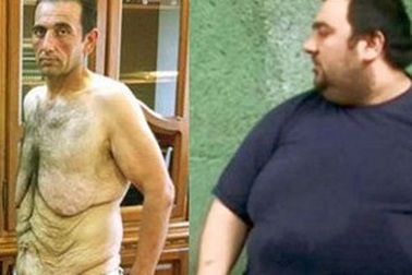 Giảm 141 kg trọng lượng cơ thể nhờ ăn kiêng