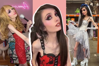 Cộng đồng mạng lo lắng cho ngôi sao mạng xã hội gầy như... bộ xương khô