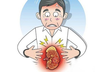 Tiểu ra máu, đau vùng lưng hông: Có thể đã mắc loại ung thư nguy hiểm này