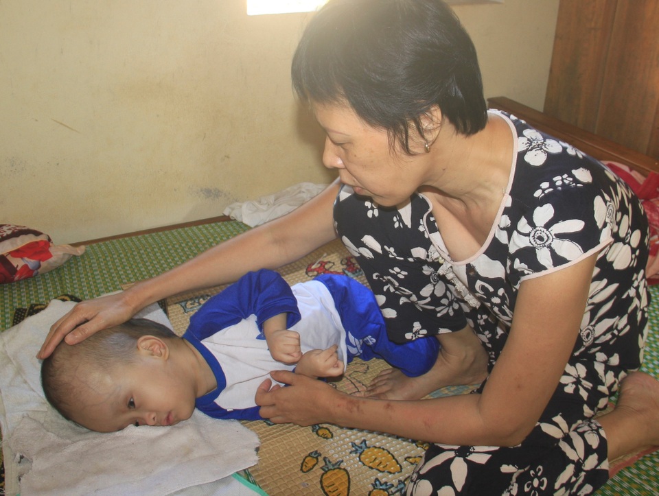 Xót xa cảnh vợ mù lòa ôm con bị não úng thủy, nằm liệt giường suốt nhiều năm! - 7 Xót xa cảnh vợ mù lòa ôm con bị não úng thủy, nằm liệt giường suốt nhiều năm! - 7