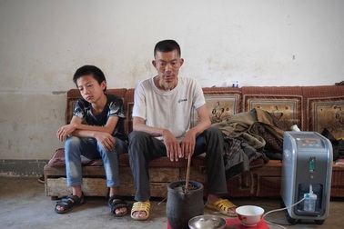 “Làng góa phụ” do bệnh bụi phổi ở Trung Quốc