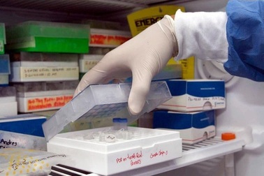 Chỉ đích danh những nguyên nhân phổ biến nhất gây ra bệnh ung thư