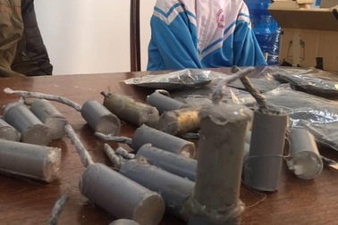 Học cách chế tạo pháo trên Youtube, nam sinh lớp 7 bị nổ bỏng mặt