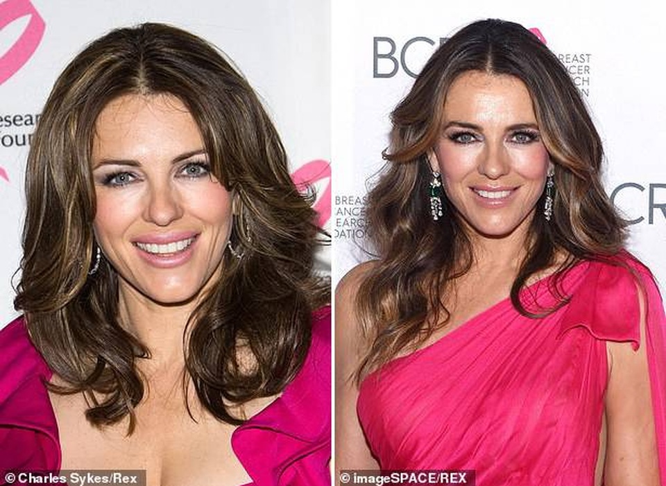 Những nhan sắc thách thức trào lưu “bền bỉ suốt một thập kỷ” - 2