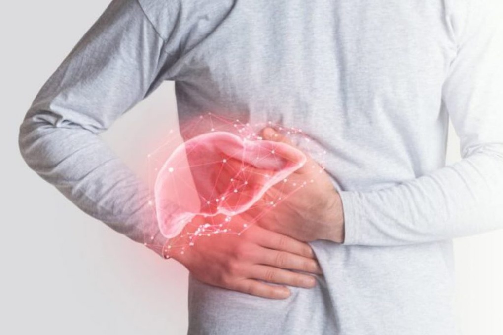 Giải đáp 6 câu hỏi thường gặp về ung thư gan - 1 Giải đáp 6 câu hỏi thường gặp về ung thư gan - 1