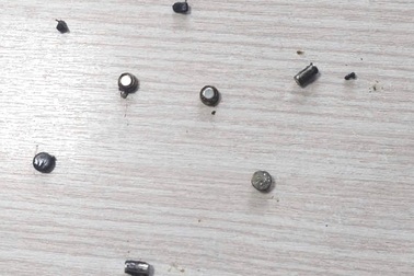 Bé trai 4 tuổi bị thủng ruột vì nuốt 10 cục pin và nam châm