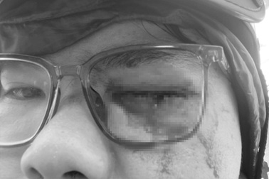 Vụ khiếu nại CSGT "va" gậy vào mắt: Thanh niên vi phạm tốc độ