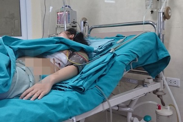 Một phụ nữ đang đi đường bị mảnh kim loại cắm sâu vào ngực