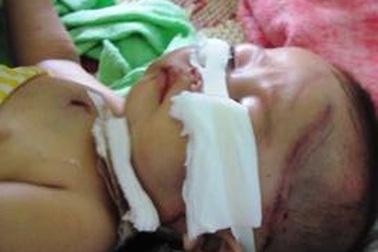 Gia cảnh ngặt nghèo của hai chị em bị bò húc trọng thương