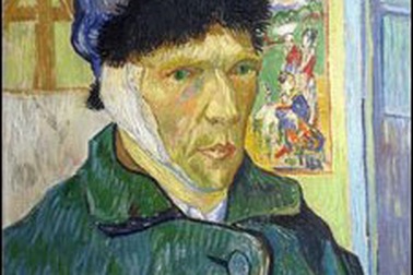 Hé mở bí ẩn đằng sau cái tai bị cắt của Van Gogh 