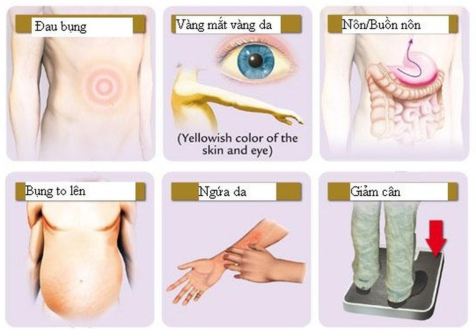 Lý do khiến chàng trai 20 tuổi đã mắc ung thư gan - 3 Lý do khiến chàng trai 20 tuổi đã mắc ung thư gan - 3