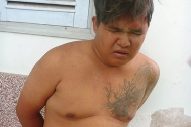 "Cẩu tặc" tấn công người dân để tẩu thoát