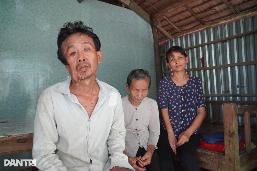 Tình cảnh bế tắc của người đàn ông bị bệnh nặng nuôi cả nhà tàn tật - 1 Tình cảnh bế tắc của người đàn ông bị bệnh nặng nuôi cả nhà tàn tật - 1