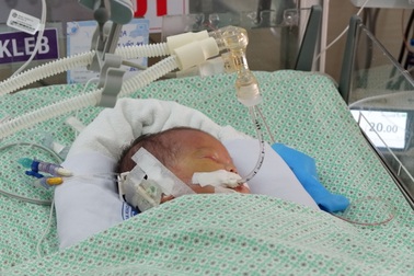 Bé sơ sinh bị bỏ rơi nhiễm khuẩn kháng thuốc nặng, 2 phổi đông đặc