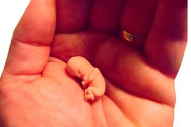 Kinh hoàng những kiểu phá thai có một không hai 