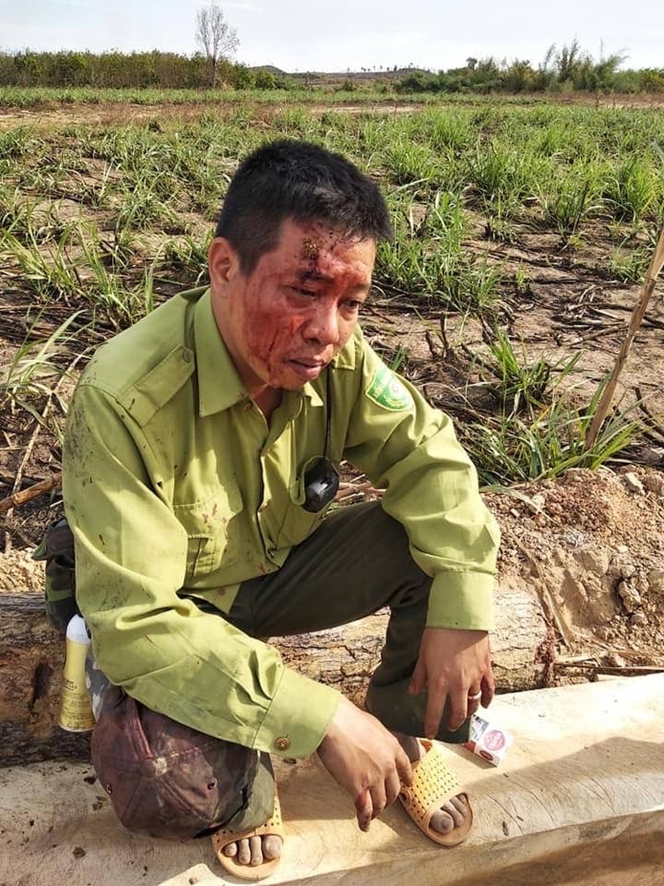 Khởi tố đối tượng vây đánh kiểm lâm toác đầu - 1 Khởi tố đối tượng vây đánh kiểm lâm toác đầu - 1