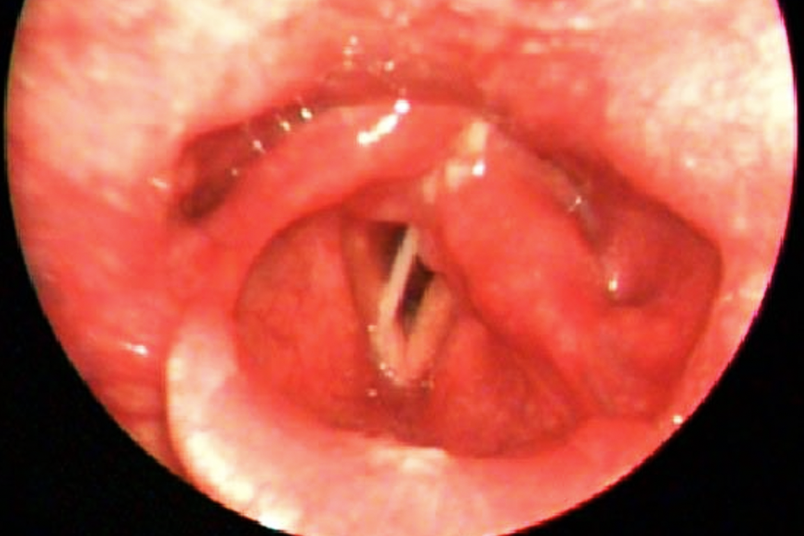 Đỡ cháu ngoại bị té, người đàn ông suýt chết khi đang ăn cá điêu hồng - 1