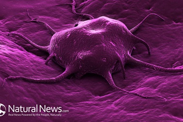 Nhận biết những dấu hiệu thường gặp và triệu chứng của bệnh ung thư