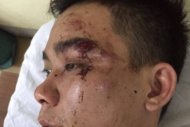 Bị nhắc nhở đi xe nguy hiểm, nhóm côn đồ hành hung dã man người đi đường