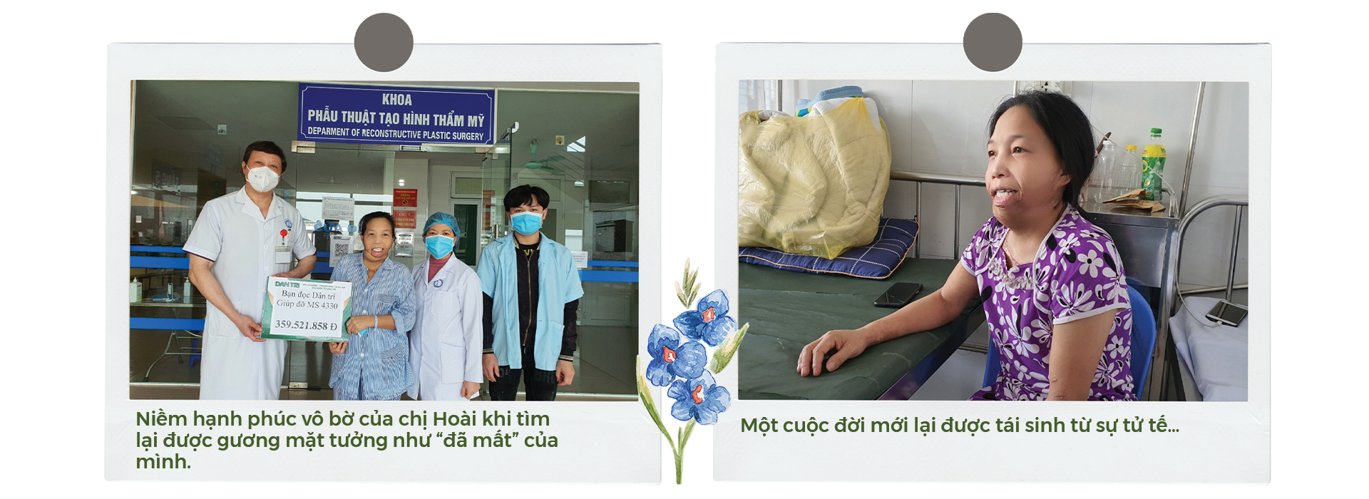 Người đàn bà 33 năm không được mang khuôn mặt con người hồi sinh kỳ diệu - 10 Người đàn bà 33 năm không được mang khuôn mặt con người hồi sinh kỳ diệu - 10