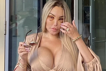 Sau khi chuyển giới, Jessica Alves lộ mặt "sưng phồng" vì thẩm mỹ