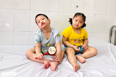 Cặp song sinh mắc bại não và động kinh, bố mẹ nghèo chết lặng