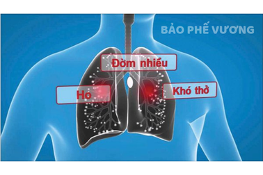 Ho, đờm kéo dài do viêm phế quản phải làm sao?