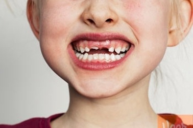 Cười hết cỡ, tăng 7 năm tuổi thọ