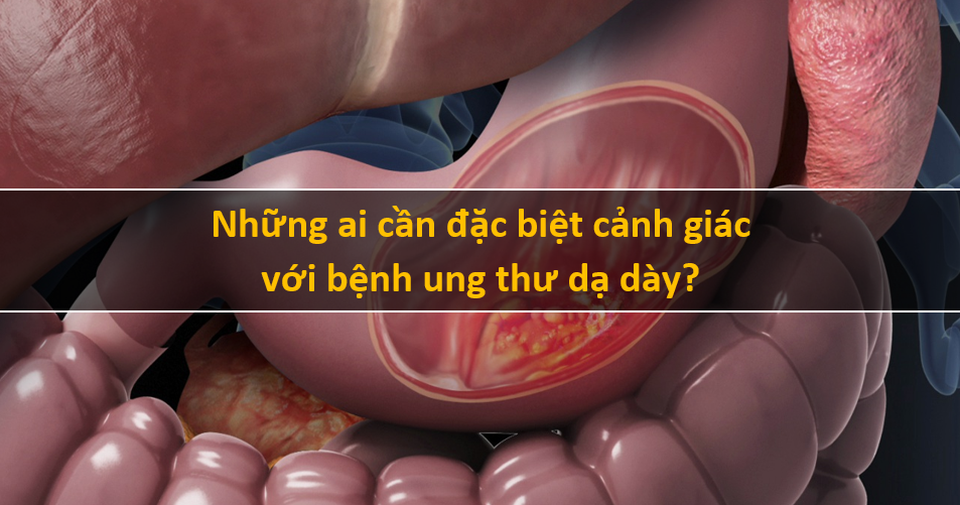 Đi ngoài phân đen: Đừng vội mừng vì nghĩ rằng cơ thể giải độc tốt! - 4 Đi ngoài phân đen: Đừng vội mừng vì nghĩ rằng cơ thể giải độc tốt! - 4