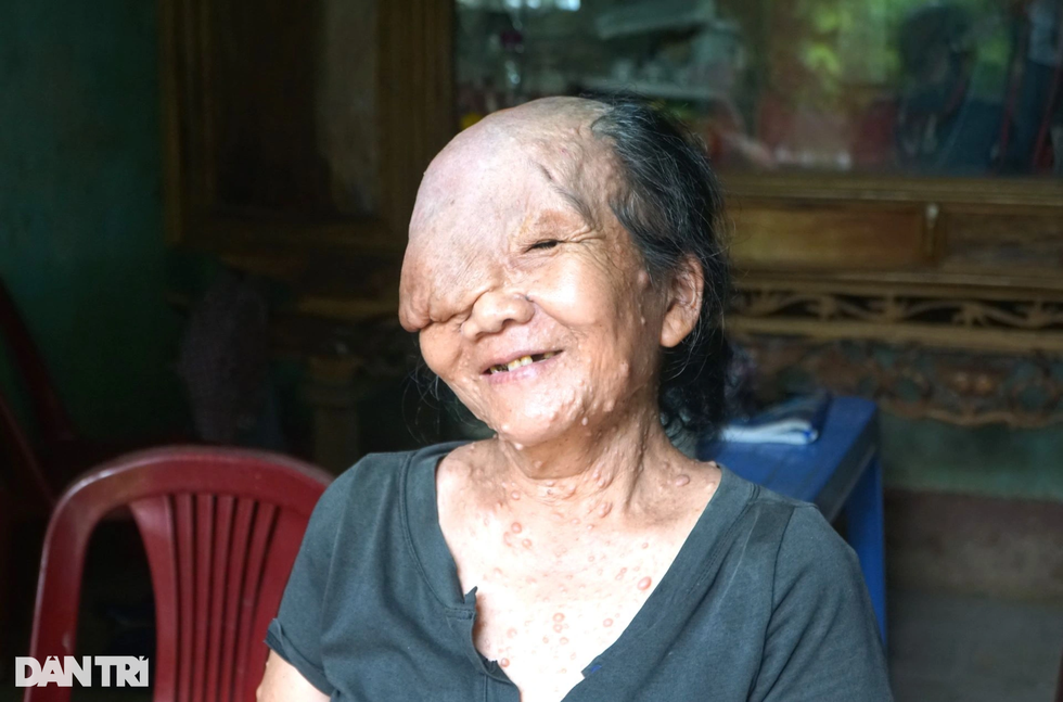 Sóng gió cuộc đời người đàn bà mang khuôn mặt quỷ - 3 Sóng gió cuộc đời người đàn bà mang khuôn mặt quỷ - 3