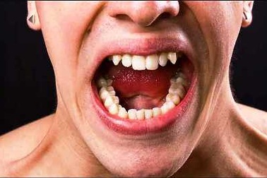 Nổi khùng vì gã hàng xóm “tự sướng” suốt ngày đêm