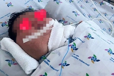 TPHCM: Bé sơ sinh mang khối bướu khổng lồ ở cổ, to như chiếc đầu thứ hai