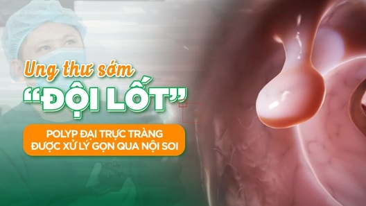 Loại bỏ nguy cơ ung thư sớm nhờ nội soi cao cấp MCU