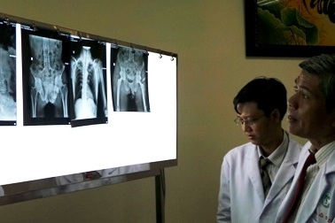 Thay 2 khớp háng cứu bệnh nhân có đốt sống dính liền