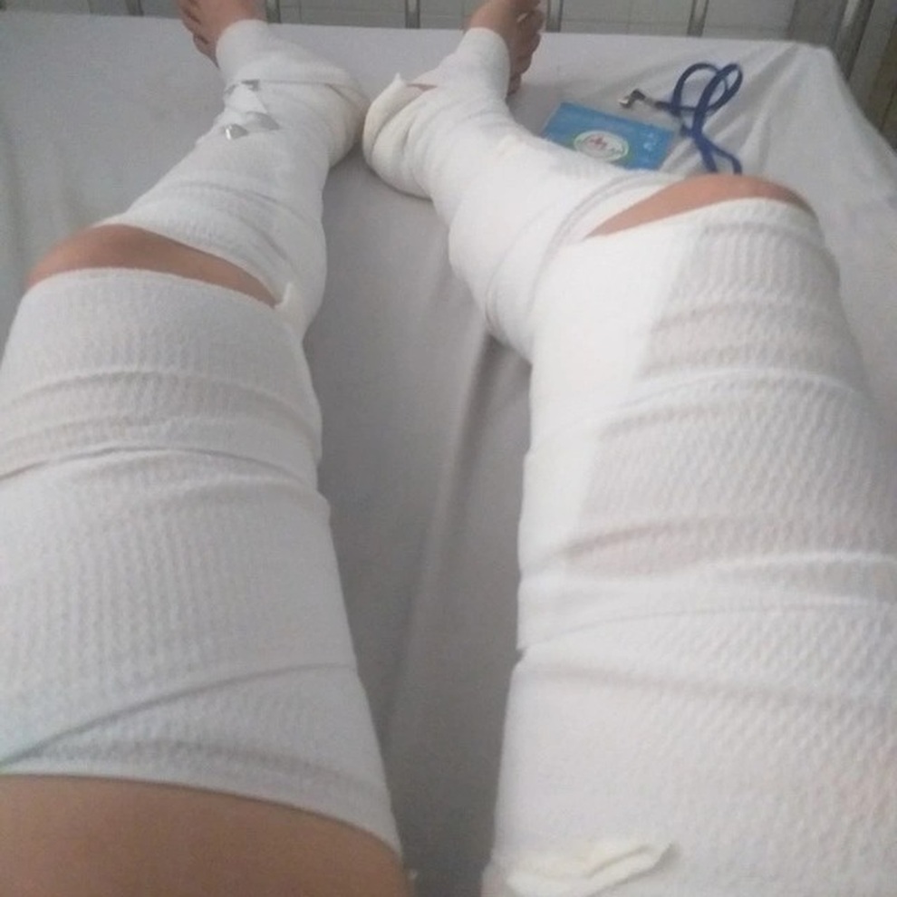 Y án vụ 3 thanh niên ném bom xăng khiến hai mẹ con suýt mất mạng - 3 Y án vụ 3 thanh niên ném bom xăng khiến hai mẹ con suýt mất mạng - 3