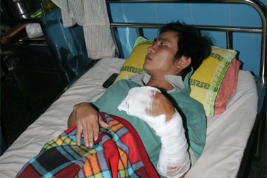 Lâm tặc lại chém đứt lìa ngón tay bảo vệ rừng