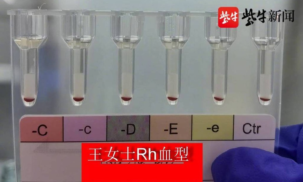 Trung Quốc phát hiện 2 phụ nữ có nhóm máu hiếm nhất thế giới - 1 Trung Quốc phát hiện 2 phụ nữ có nhóm máu hiếm nhất thế giới - 1