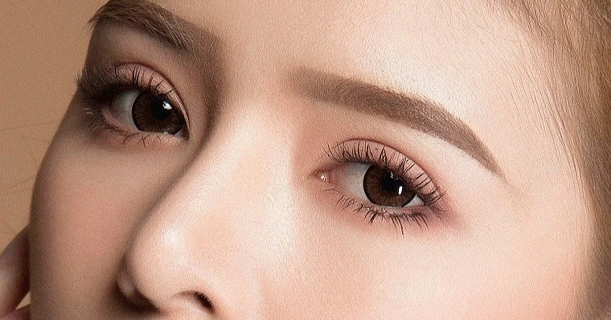 Cắt mí 5 ngày không nhắm được mắt, bác sĩ cảnh báo nguy cơ