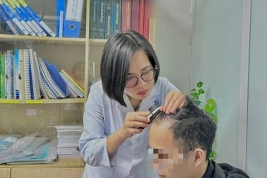 Bác sĩ chỉ thói quen khiến nhiều người trẻ hói đầu, rụng tóc