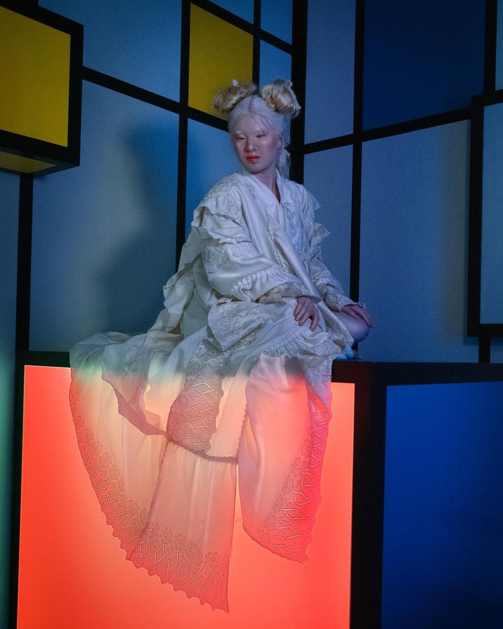 Cô gái bạch tạng từng bị cha mẹ bỏ rơi, trở thành người mẫu tạp chí Vogue - 7